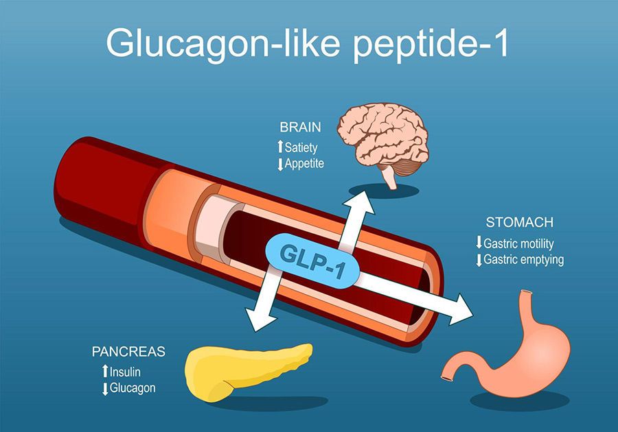 GLP-1 ธรรมชาติ ช่วยลดน้ำหนัก ลดดื้ออินซูลินและเบาหวานอย่างไร